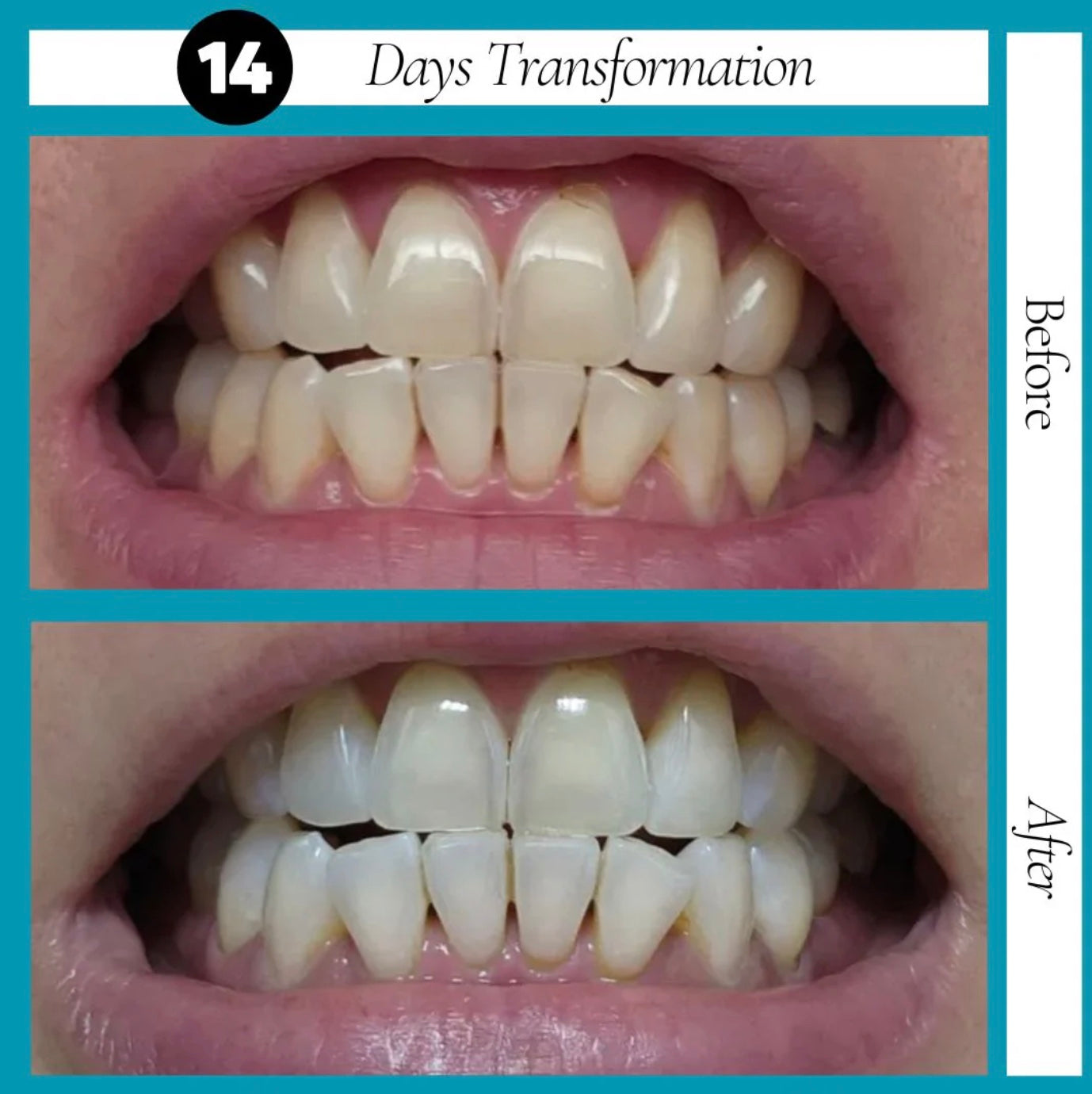 GURU NANDA™ - Coconut Oil Mouthwash